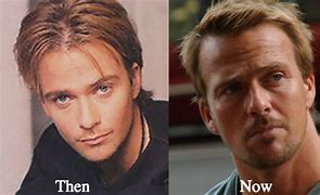 Image result for Sean Patrick Flanery Plastic Surgery