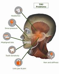 Image result for Jaw Bone Pain