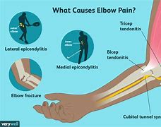 Image result for Arm Elbow Pain