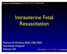 Image result for Intrauterine Fetal Resuscitation