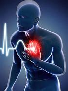 Image result for Heart Attack or Stroke