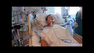 Image result for Head Surgery Recovery Patient