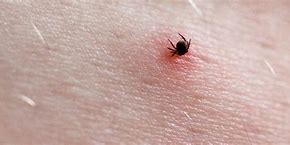 Image result for Small Ticks On Humans