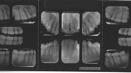 Image result for FMX Digital X-rays