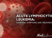 Image result for Acute Lymphocytic Leukemia