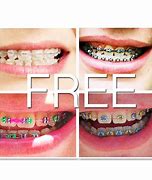 Image result for How to Make Fake Braces without Earring Backs