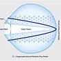 Image result for Multifocal Contact Lenses for Eye Side