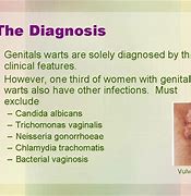 Image result for Female Genital Warts Inside