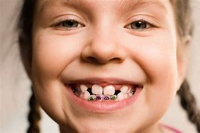 Image result for Kids Orthodontics