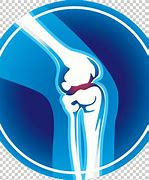 Image result for Walking After Knee Surgery Clip Art