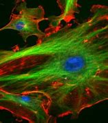 Image result for Viral Cell Structure