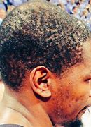 Image result for Kevin Durant Head Balding