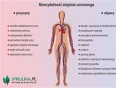 Image result for co_oznacza_zastoinowa_niewydolność_serca