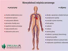 Image result for co_to_znaczy_zapalenie_mięśnia_serca
