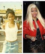 Image result for Nicki Minaj Before and After Skin Bleaching