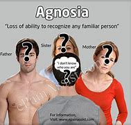 Image result for agnosis