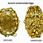 Image result for Telur Ascaris Lumbricoides