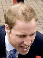 Image result for Prince William Balding