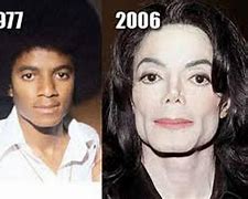 Image result for Michael Jackson Nose Before and After