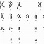 Image result for Heterozygous Type A