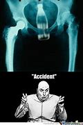 Image result for Cancer X-ray Memes