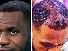 Image result for LeBron James Hairline Meme