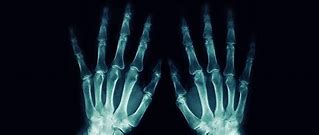 Image result for Human Hand X-ray
