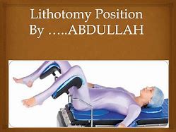 Image result for Lithotomy Position