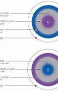 Image result for Multifocal Hard Contact Lenses