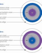 Image result for Multifocal Contact Lenses Malaysia