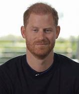 Image result for Prince Harry Hair Piece