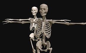 Image result for Lady That Looks Like Skeleton