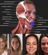 Image result for Jaw Defining Exercises