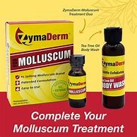 Image result for Molluscoum Contagiosum Treatment