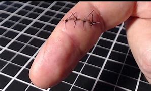 Image result for stitches up