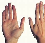 Image result for Palm and Back of Hand