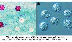 Image result for cyclospora_cayetanensis
