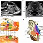 Image result for Brain Sizes Smallest to Largest