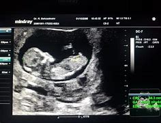 Image result for Boy Pregnancy Announcement
