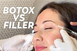 Image result for Botox vs Fillers