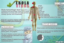 Image result for apb�rbola