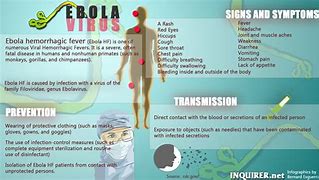 Image result for aob�rbola