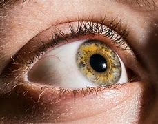 Image result for Yellow Iris Eyes