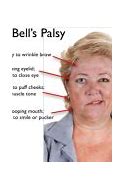 Image result for Bell's Palsy Meme