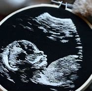 Image result for Cute Ways to Display Ultrasound