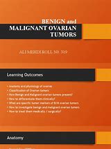 Image result for Ovarian Cancer Tumor