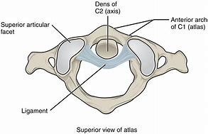 Image result for Anterior Arch of Atlas