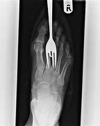 Image result for Funny Leg X-ray