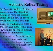 Image result for Acoustic Blink Reflex