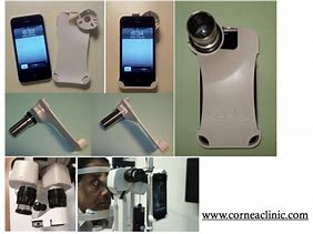Image result for iPhone Slit Lamp Adapter